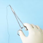 手術の傷痕を残さない｢縫合｣とは? チェックするべき5つのポイント