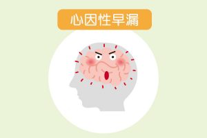 心因性早漏の原因と治療法【簡単・手軽に実践できる】