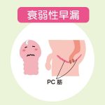 衰弱性早漏の原因と治療法【中折れやED防止にも効くトレーニング法】