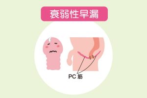 衰弱性早漏の原因と治療法【中折れやED防止にも効くトレーニング法】