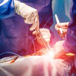 手術の傷痕を残さない｢切開｣とは? チェックするべき4つのポイント