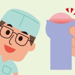 包茎の剥き癖のつけ方~自力で包茎を治す!