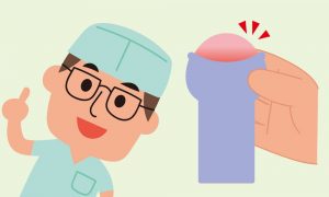 包茎の剥き癖のつけ方~自力で包茎を治す!