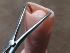 キトー君DXを自腹購入したので本音でレビュー! ~ 本当に包茎は治る?